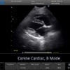 5-cardiac