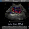 6-kidney