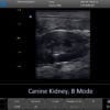 6-kidney3