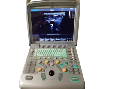 CHISON Q9 VET Ultrasound-Used