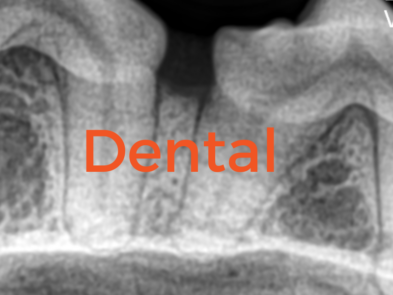 Dental