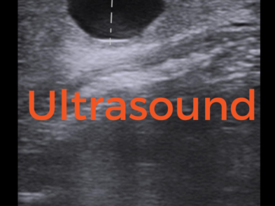 Ultrasound